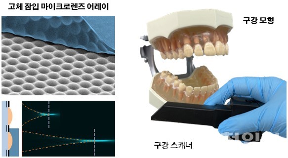 KAIST, 3차원 구강 스캐닝 라이트필드 카메라 개발…소형화·높은 정확도 달성 관련 이미지